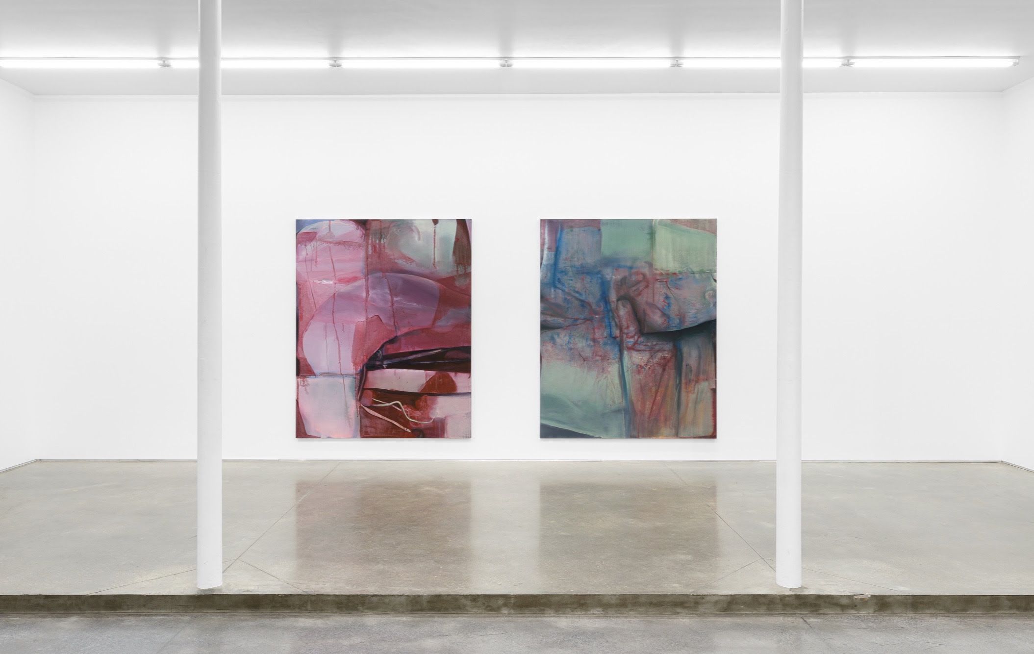 Keunmin Lee, When Hallucination Is No Longer a Symptom at Derouillon, photo 2