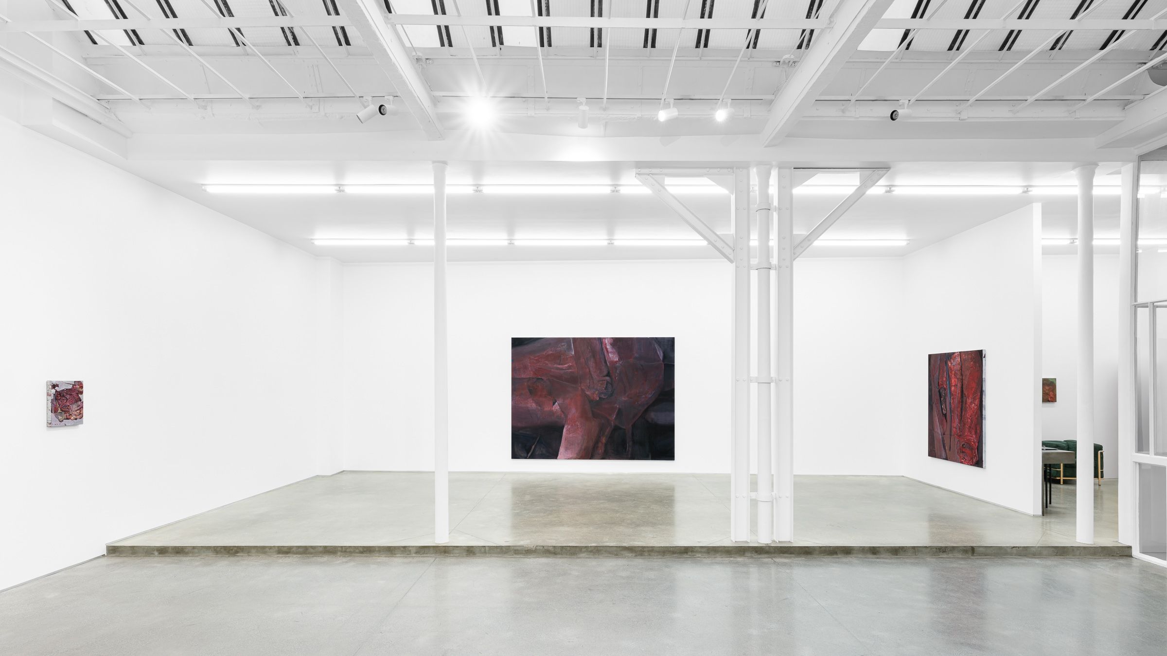 Keunmin Lee, When Hallucination Is No Longer a Symptom at Derouillon, photo 5