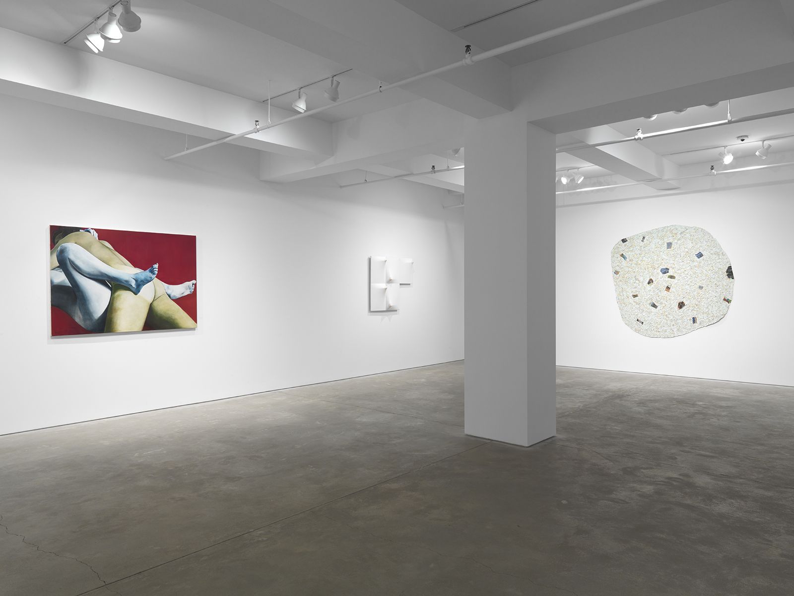 Skins: Body as Matter and Process, Skins: Body as Matter and Process at Garth Greenan, photo 2