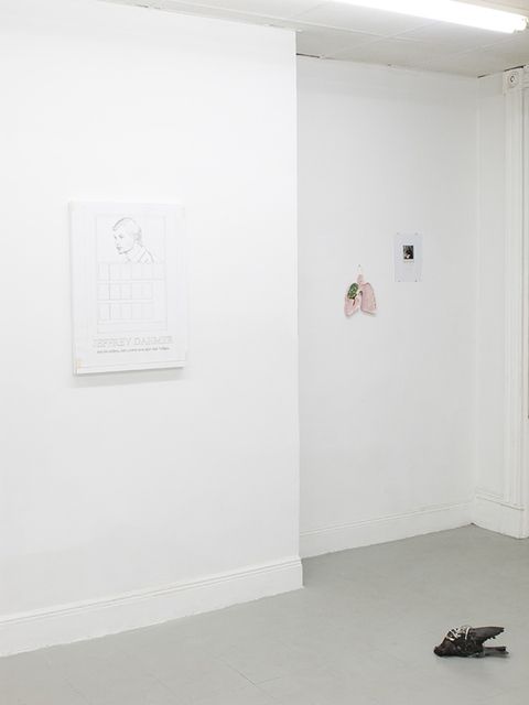 Suppedaneum, image 2 of 4