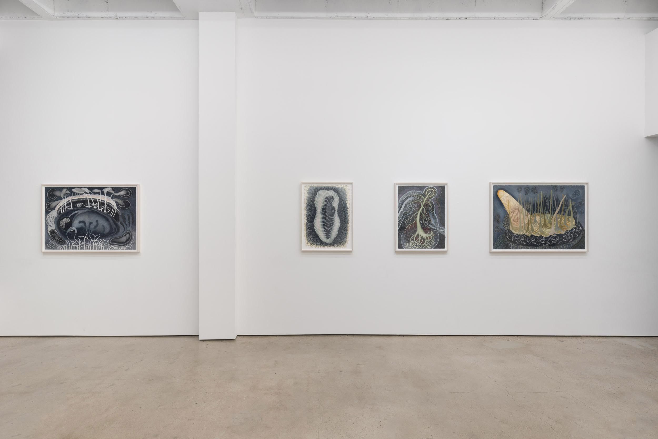 Ann Leda Shapiro, Diagnosing Disturbances at François Ghebaly, photo 3