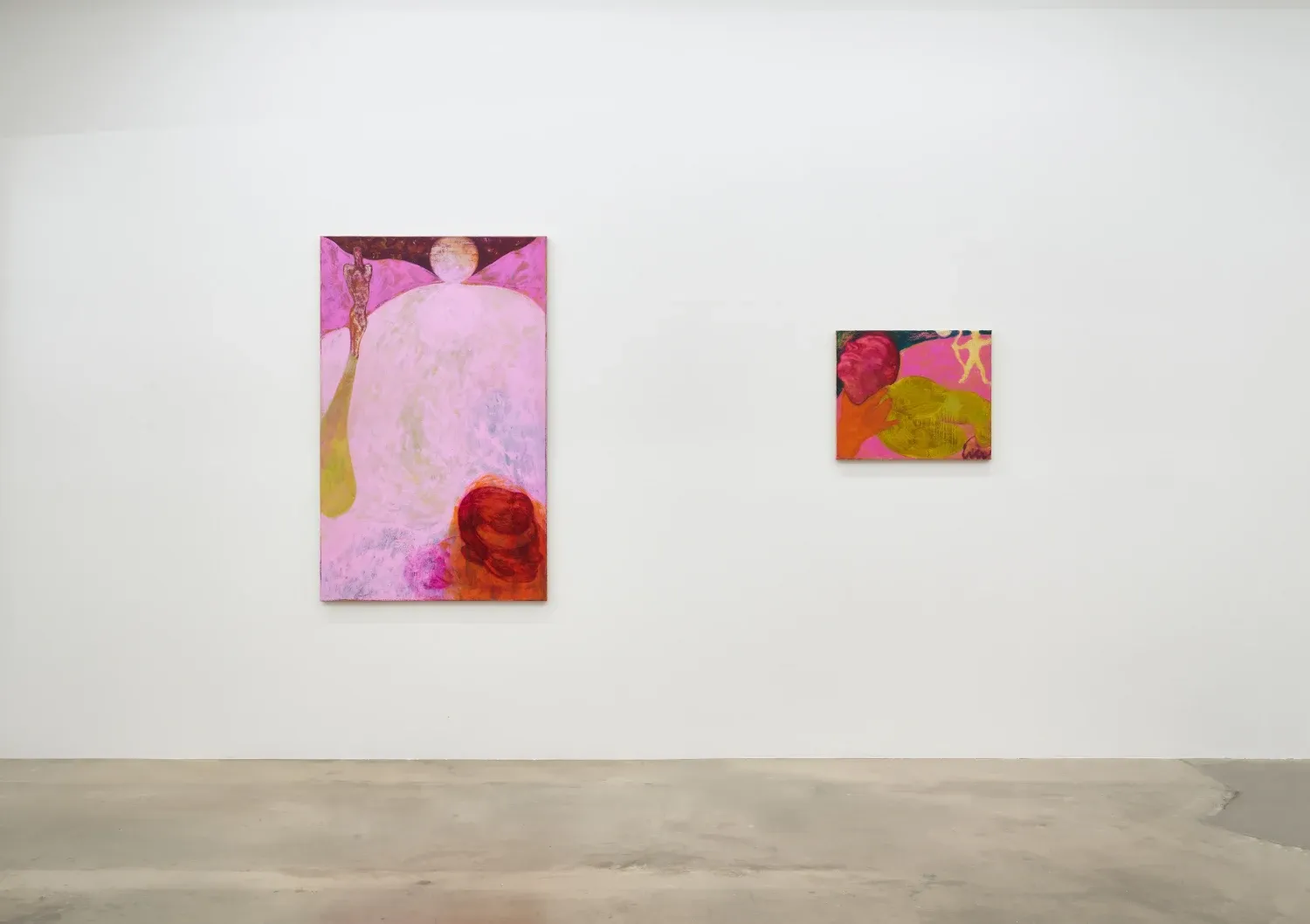 Alex Foxton, Sebastian at Various Small Fires, photo 2
