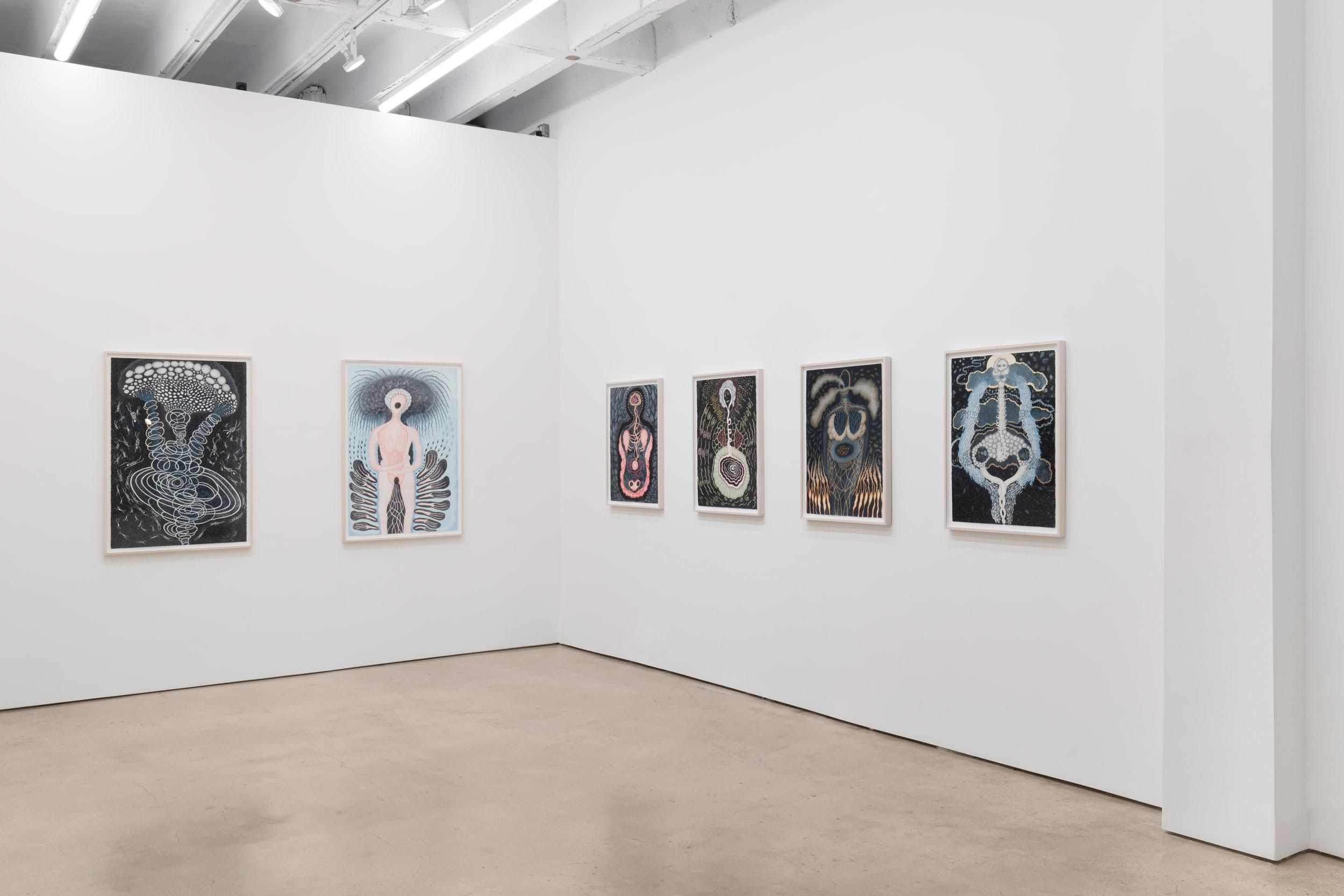Ann Leda Shapiro, Diagnosing Disturbances at François Ghebaly, photo 4