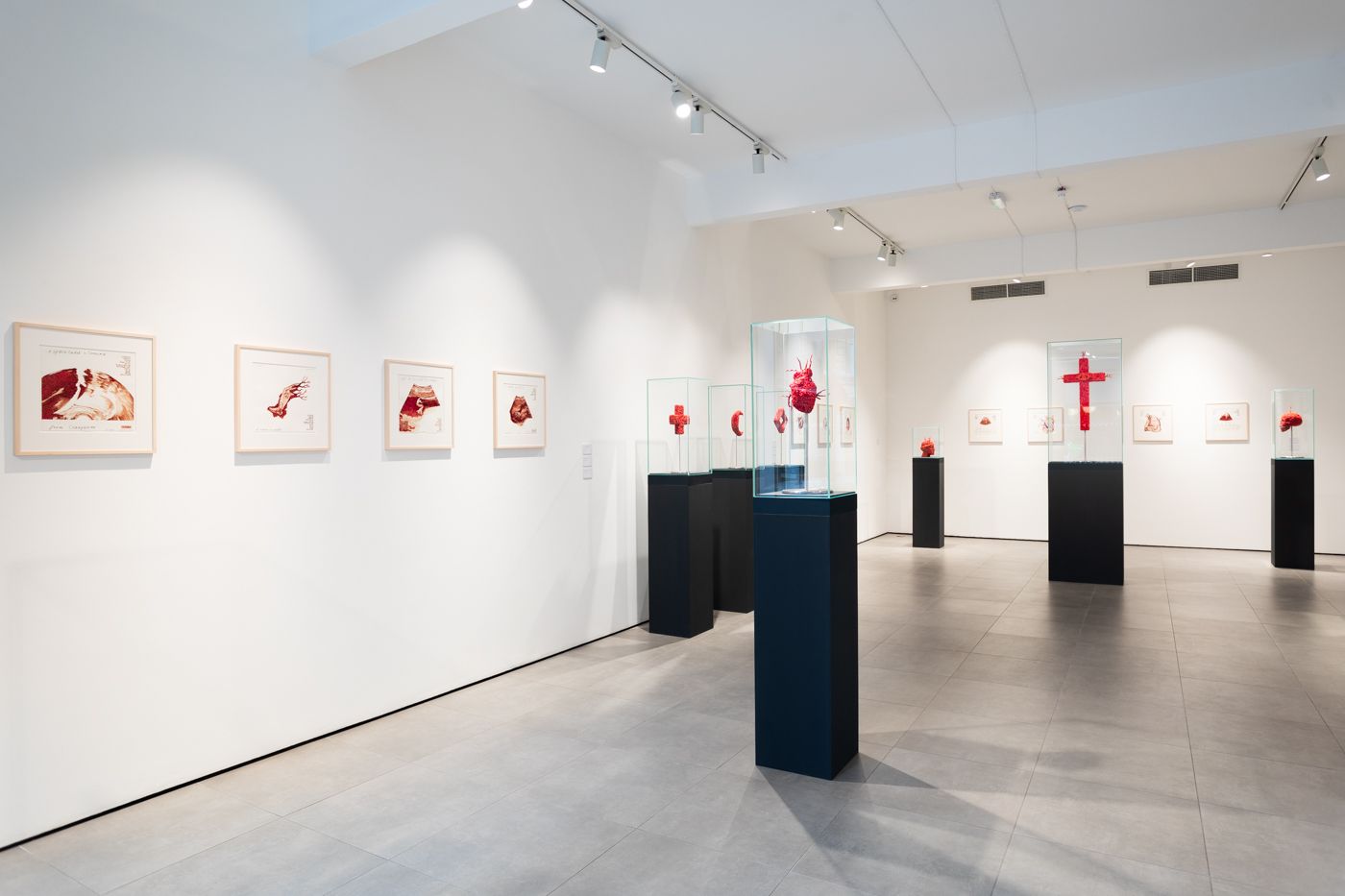 Jan Fabre, Allegory of Caritas (An Act of Love) at Mucciaccia Gallery, photo 3