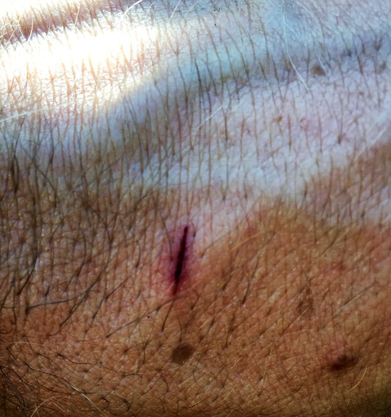 Shooting Blanks, Shooting Blanks at 67 Steps, photo 3