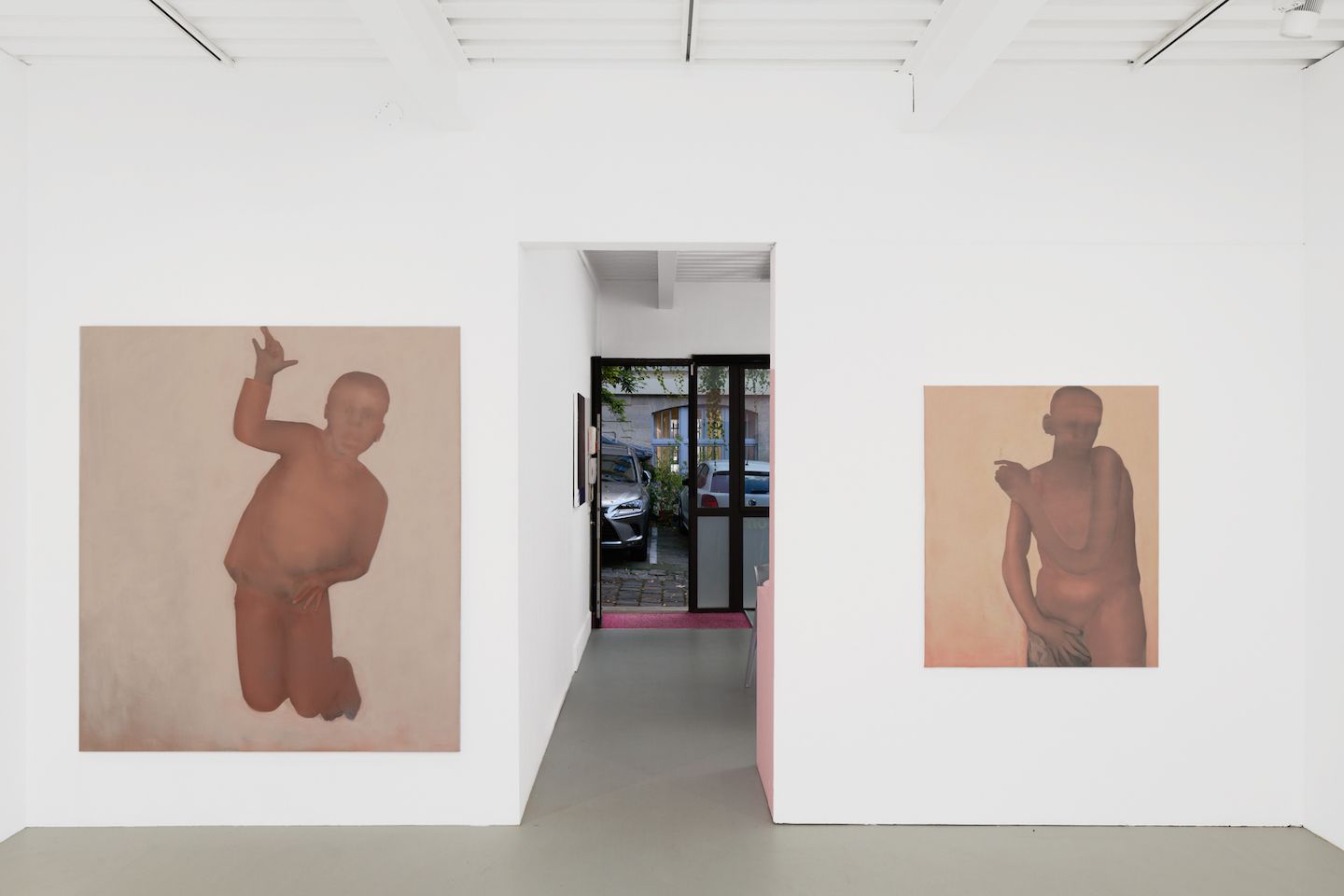 Michael Igwe, Tantrum at Superzoom, photo 2