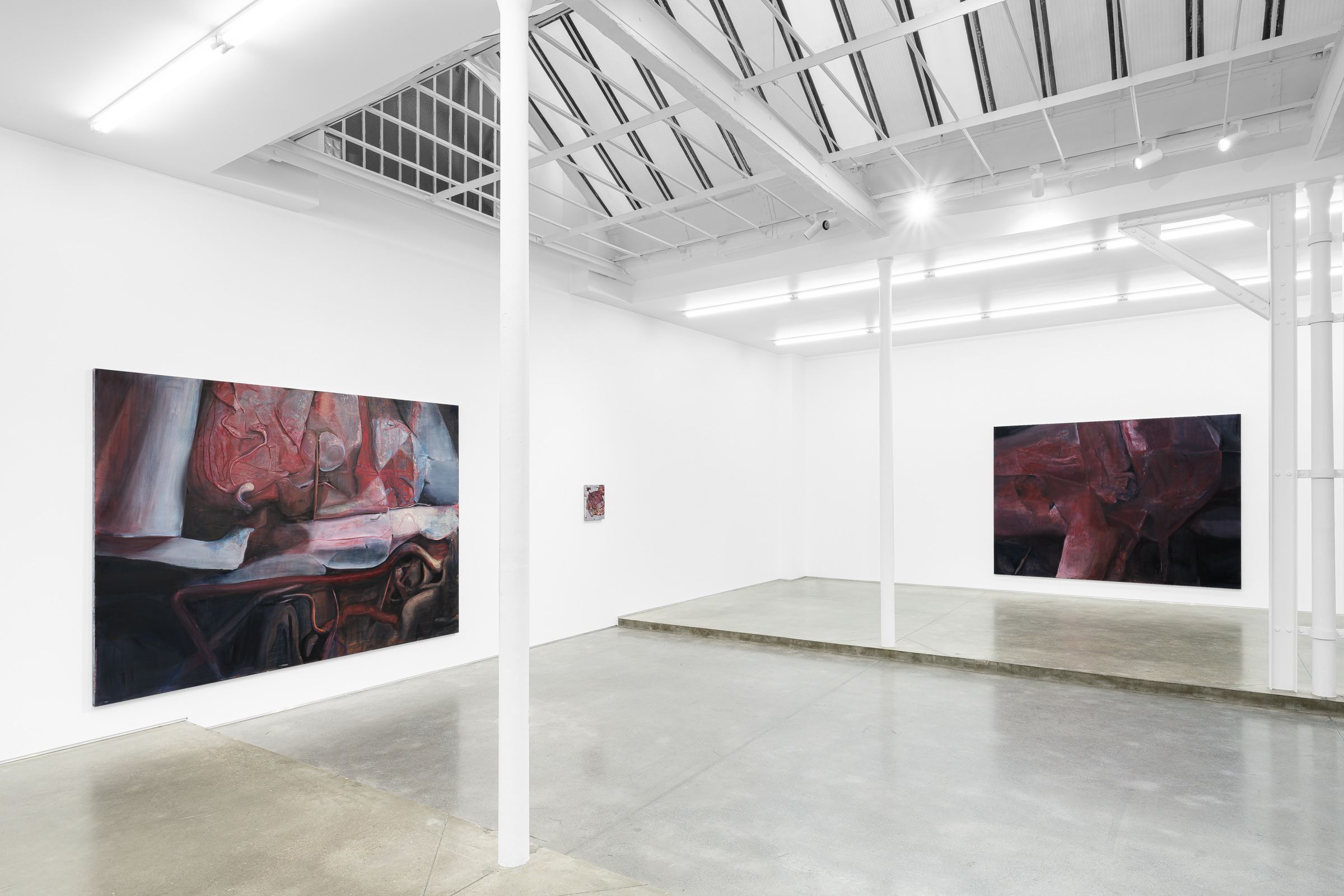 Keunmin Lee, When Hallucination Is No Longer a Symptom at Derouillon, photo 4