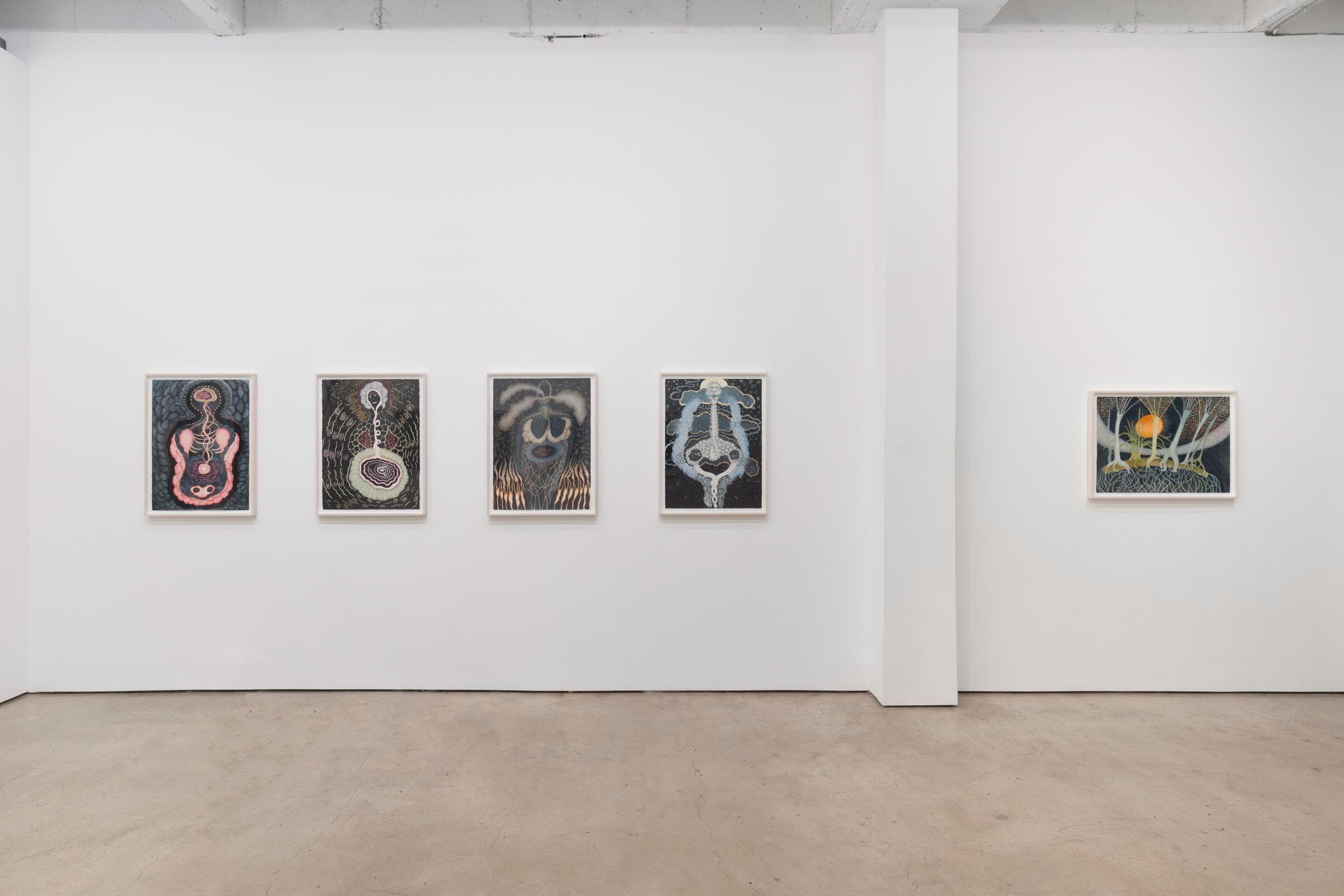 Ann Leda Shapiro, Diagnosing Disturbances at François Ghebaly, photo 5