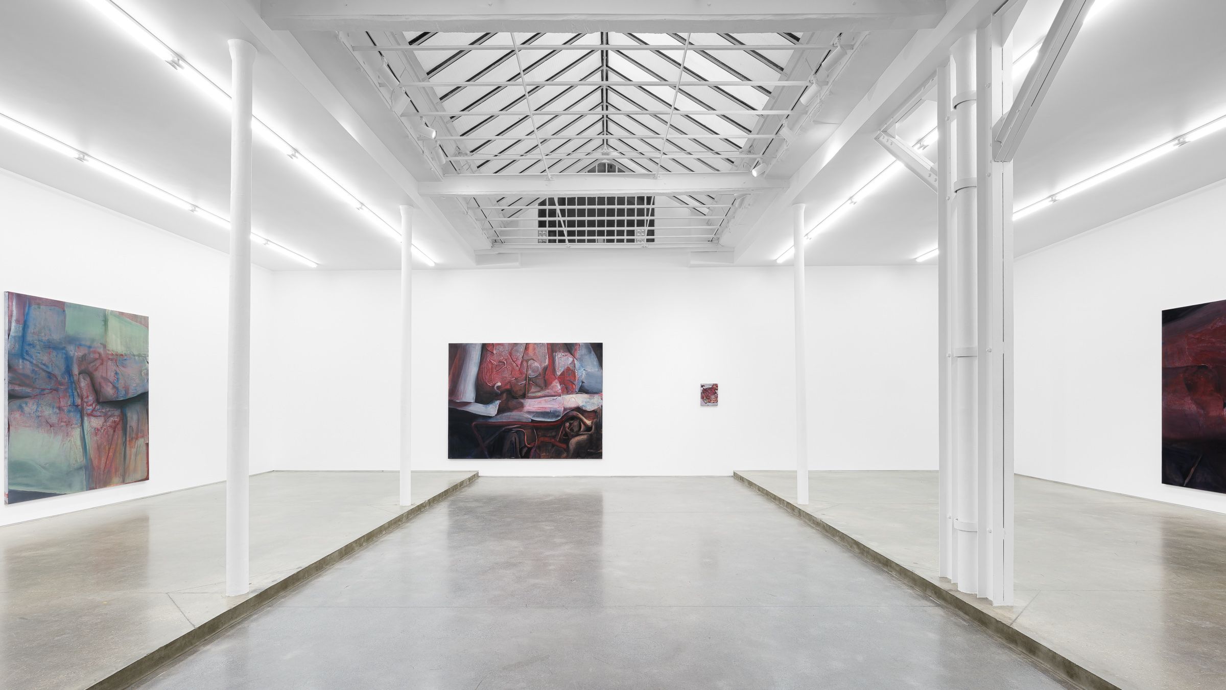 Keunmin Lee, When Hallucination Is No Longer a Symptom at Derouillon, photo 3