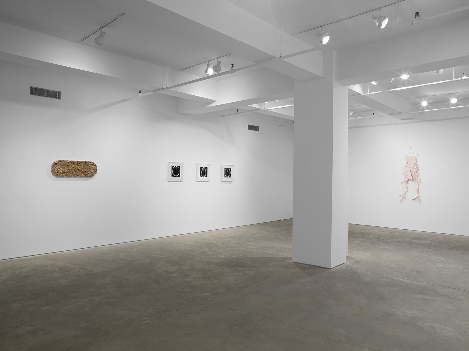 Skins: Body as Matter and Process, Skins: Body as Matter and Process at Garth Greenan, photo 4